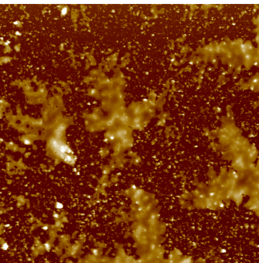 AFM scan of a dried tear from a glaucoma patient